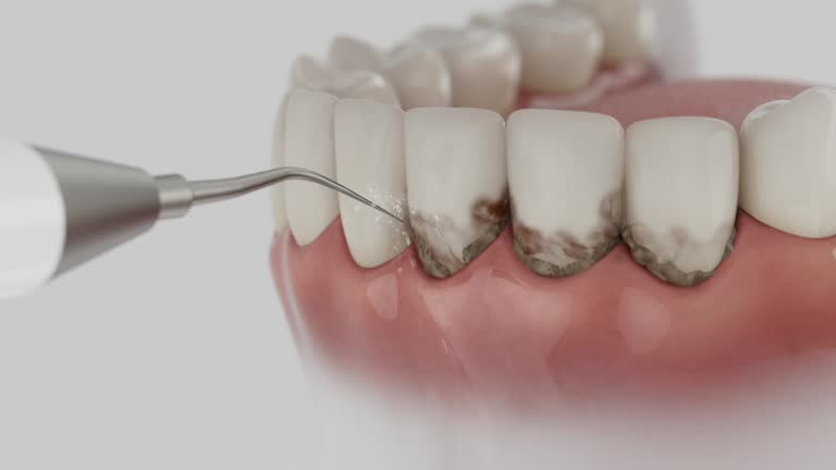Reliable Dental contractor in Liberty, UT by Smile Center Dentistry